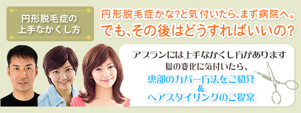 円形脱毛症の上手なかくし方