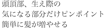 気になる部分だけピンポイント簡単に髪が増やせる